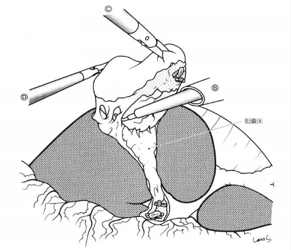 1650440893445462.png image.png