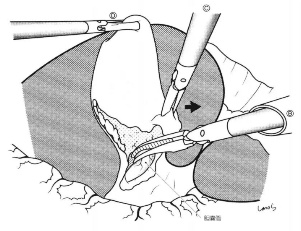 1650446242165850.png image.png